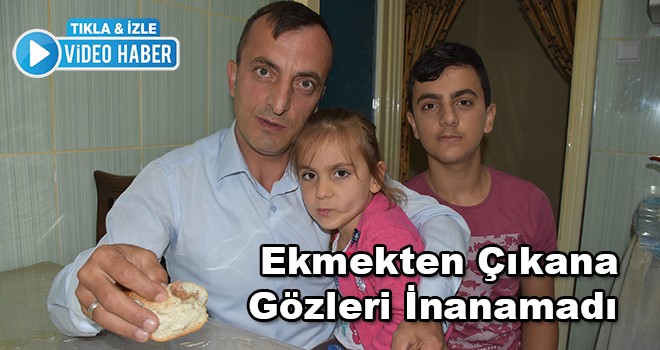 Ekmekten Yara Bandı Çıktı